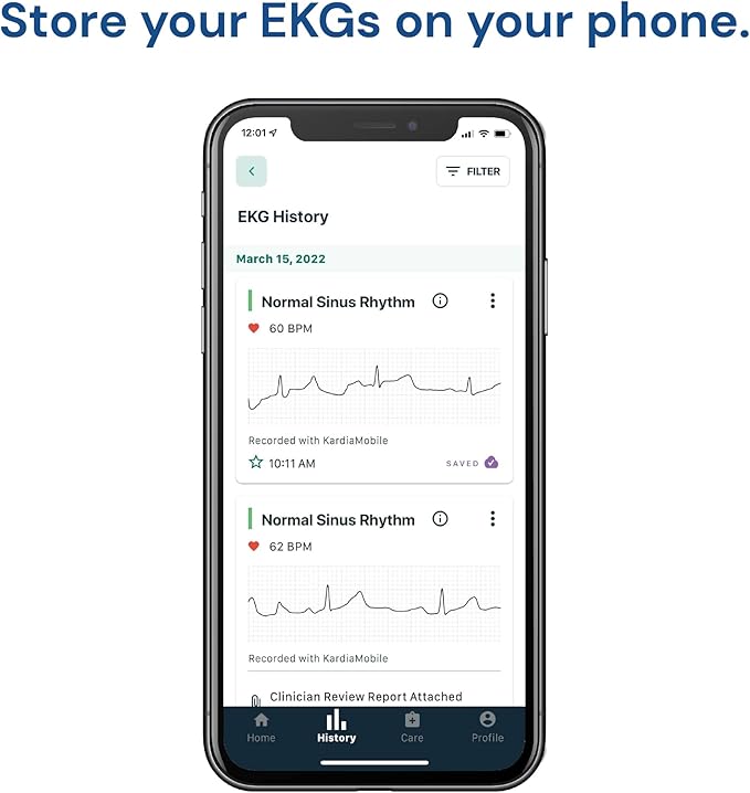KardiaMobile 1-Lead Personal EKG Monitor – Record at Home – Detects AFib & Irregular Arrhythmias – Easy Results in 30 Seconds – Works w/Most Smartphones