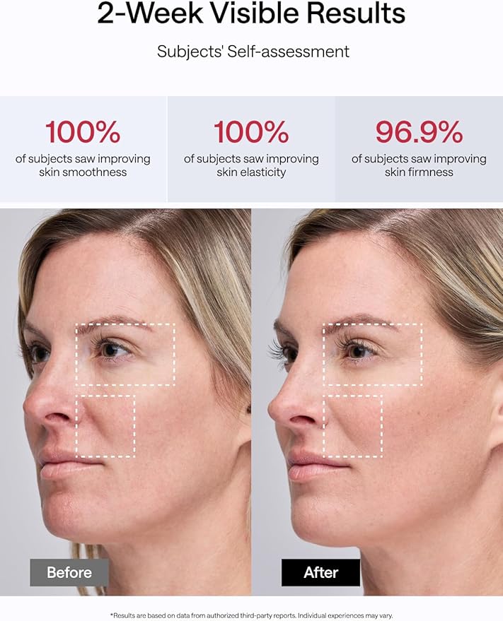 JMOON NouvelleSkin Facial Toning Device, FDA-Cleared Microcurrent Facial Device and Red Light Therapy for Face, 4 Modes & 5 Intensity Levels for Personalized Face Lift & Smoothing. M30U PR