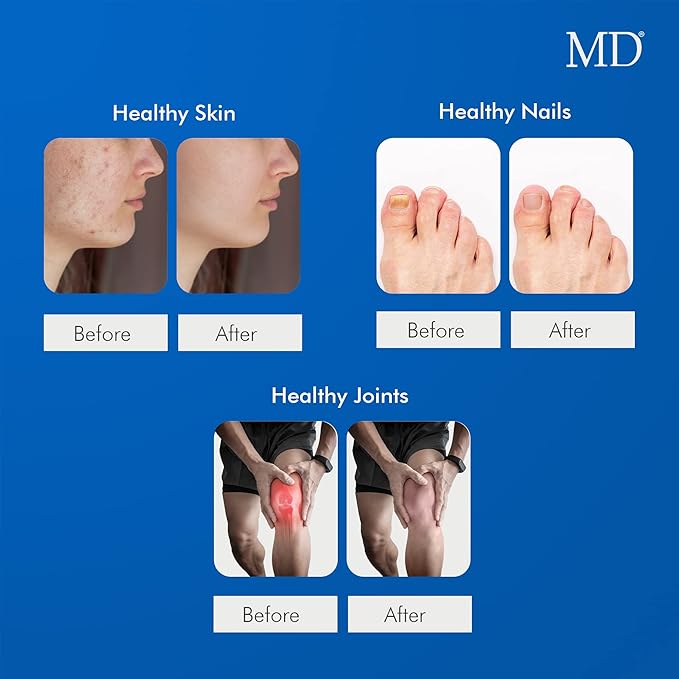 MD Ultimate Beauty Drink Powder CollagenType I & III | Collagen Dietary Supplement with Antioxidants | Provides Nutritional Support to Skin, Hair, Nails, Joints | 150 Grams